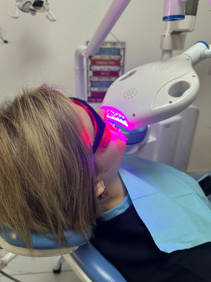 הלבנת שיניים מקצועית